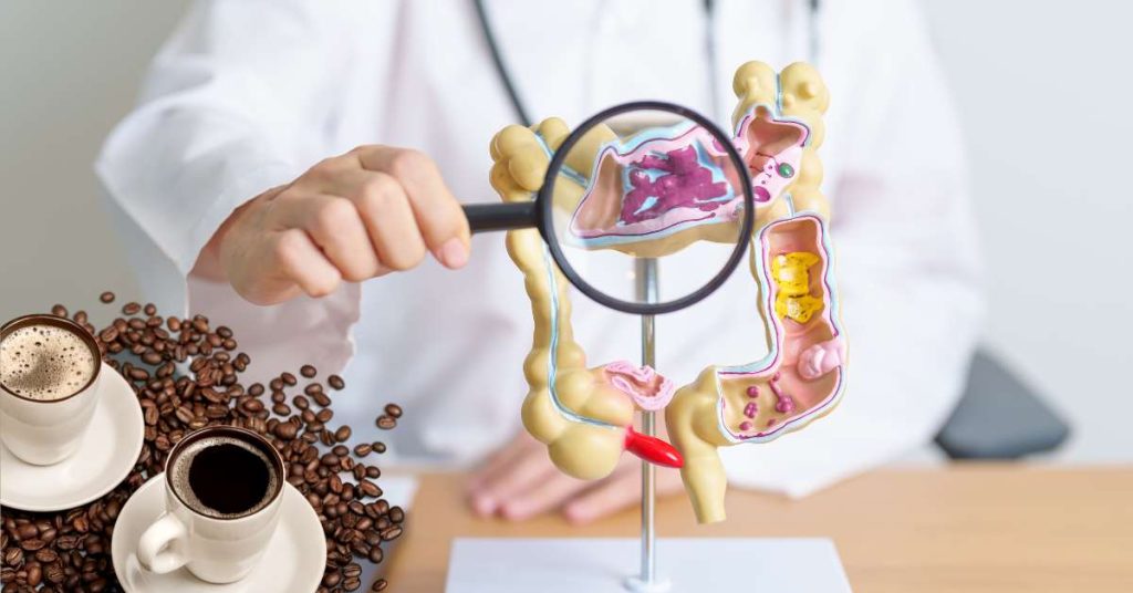 Cà phê hỗ trợ phòng ngừa IBS