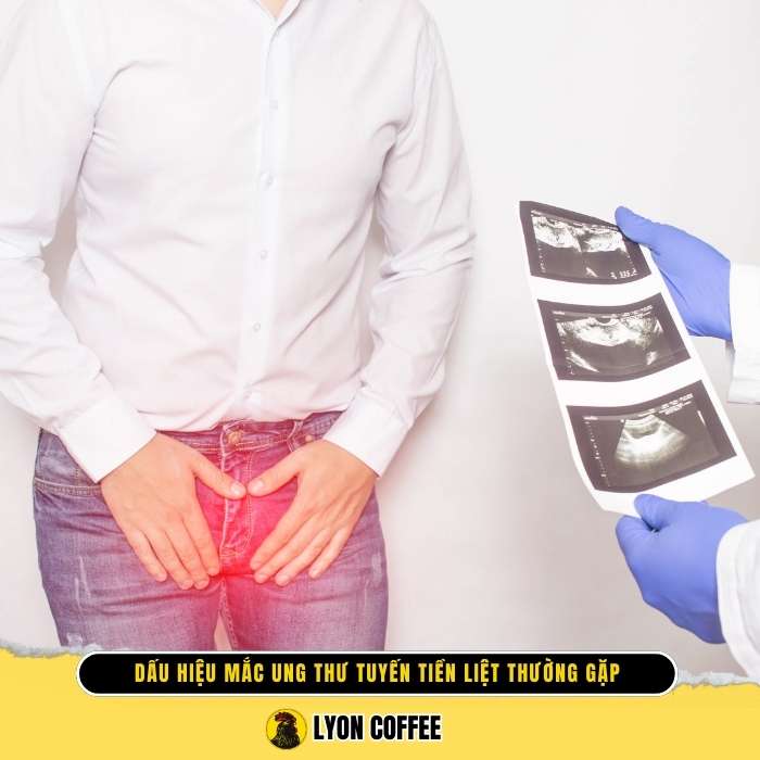 Uống cà phê giúp chống lại ung thư tuyến tiền liệt